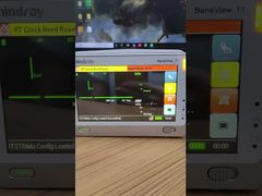 ดูเหตุใดจึงเลือกหน้าจอมอนิเตอร์ผู้ป่วย Mindray BeneView T1 พร้อมฝาครอบด้านหน้า