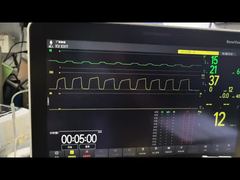 ดูการสาธิตโมดูล Mindray AG AG และโมดูล O2 โมดูล MMS PN 115-023943-00