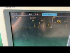 มองใกล้ยิ่งขึ้น: กับดักน้ำ Mindray สำหรับโมดูลแก๊สดมยาสลบในเด็กผู้ใหญ่ 9200-10-10530
