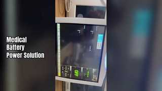 แนะนำอุปกรณ์เสริมอุปกรณ์การแพทย์แบตเตอรี่โมดูล PDM ที่เข้ากันได้กับ GE สำหรับคุณ